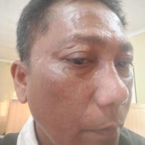 Oplus_131072